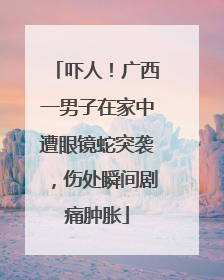 吓人！广西一男子在家中遭眼镜蛇突袭，伤处瞬间剧痛肿胀